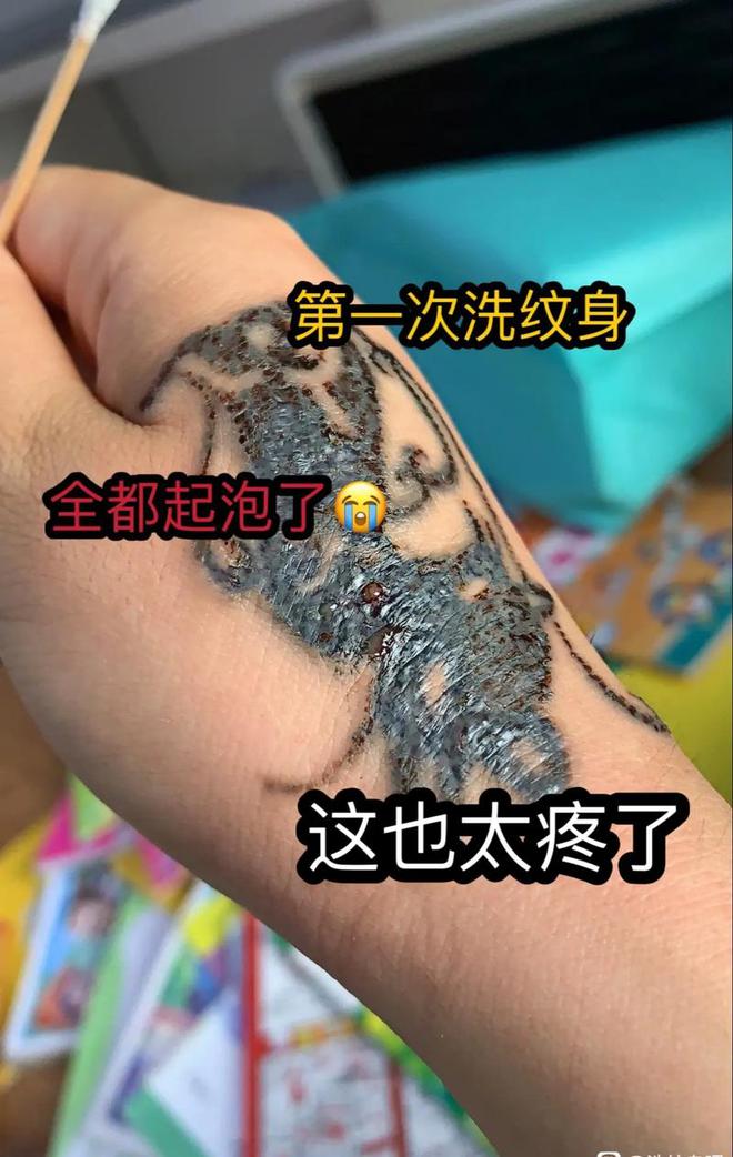 150元文身76万清洗费撕裂未成年人的“皮肤生意”谁在纵容？(图3)